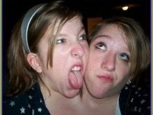 Abby Hensel
