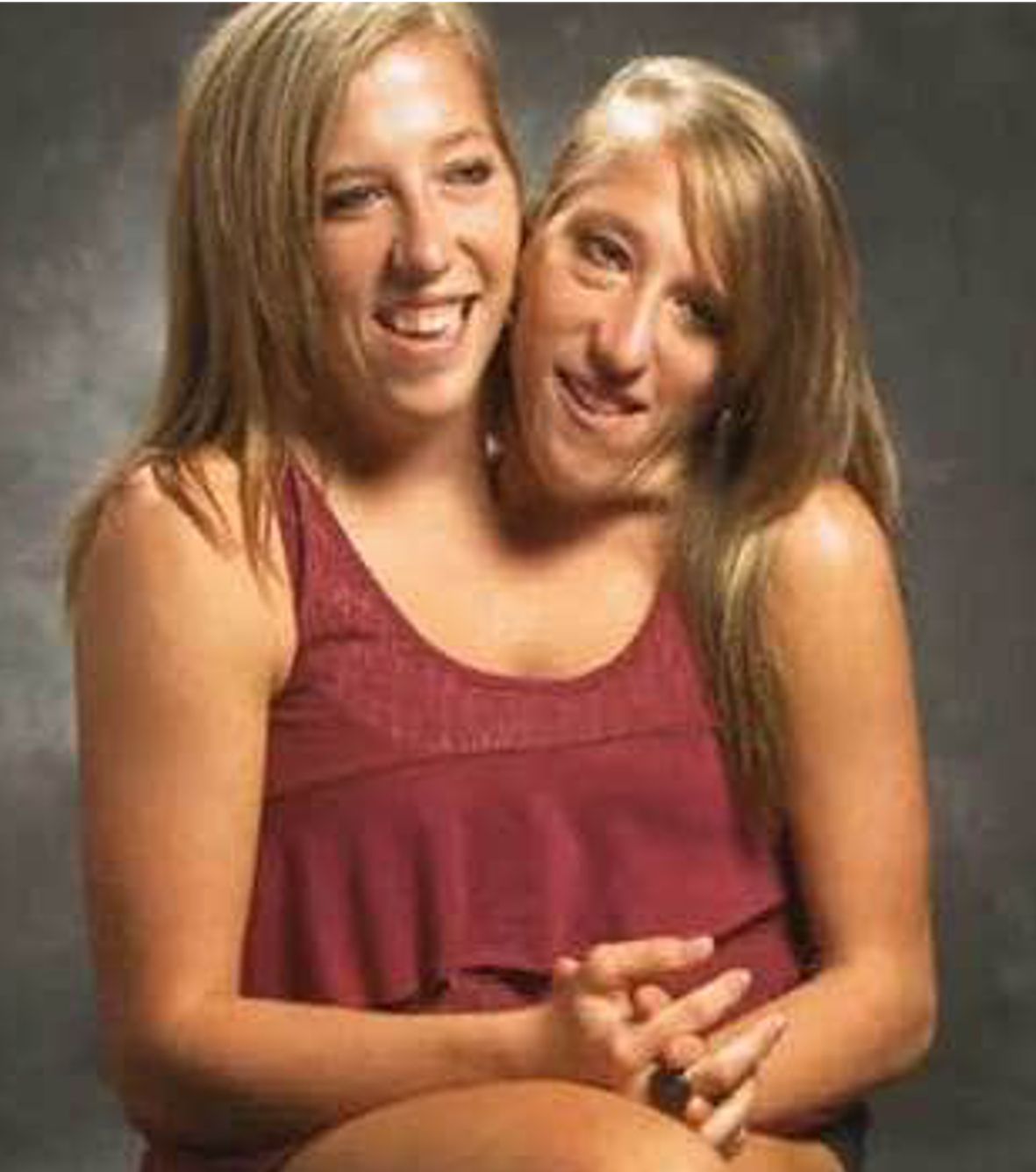 Abigail And Brittany Hensel Porn