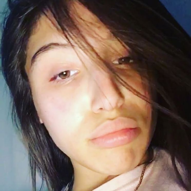 Abella Danger
