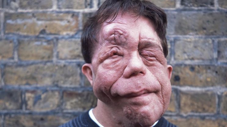 Adam Pearson