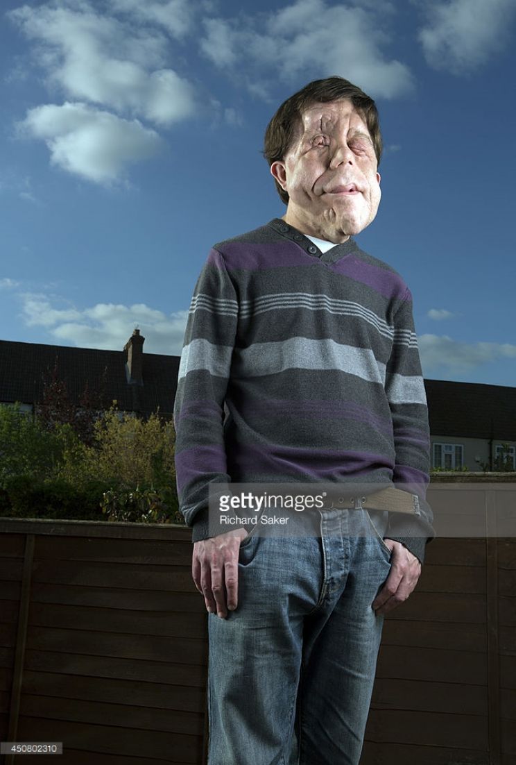 Adam Pearson