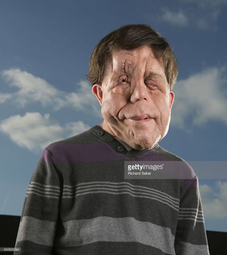 Adam Pearson