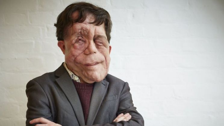 Adam Pearson