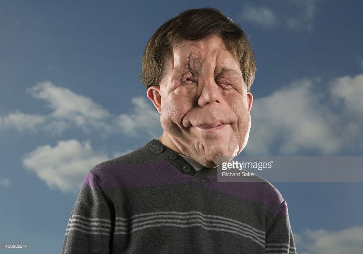 Adam Pearson