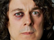 Alan Davies