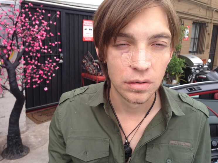 Alex Band
