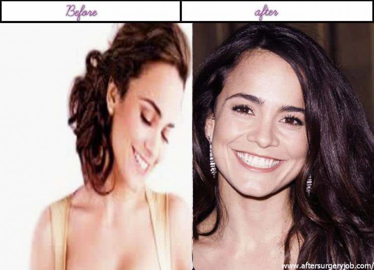 Alice Braga