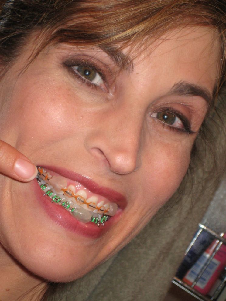 Alicia Alighatti
