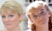 Alison Arngrim