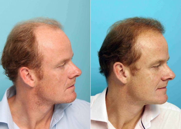 Alistair Petrie