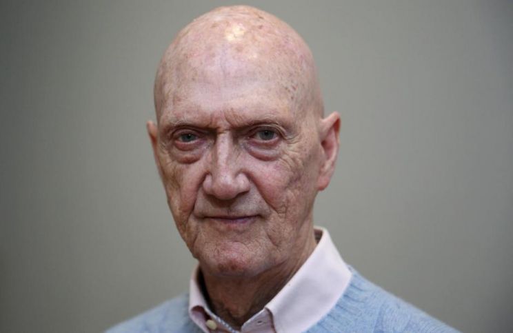 Allen Jones