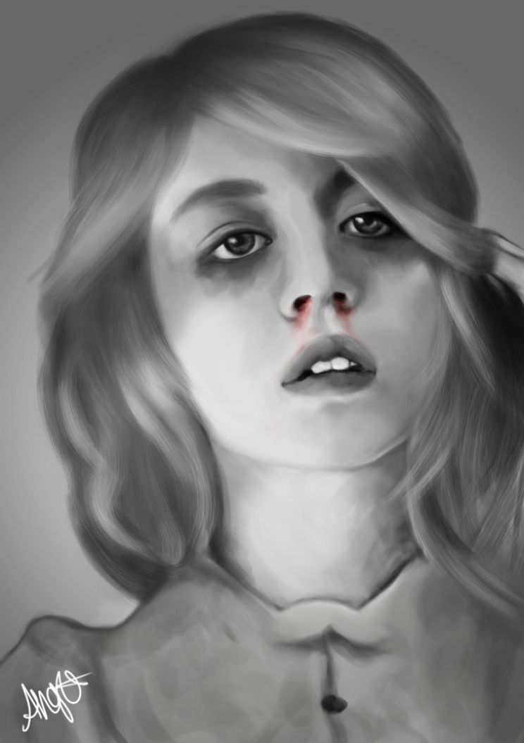 Allison Harvard