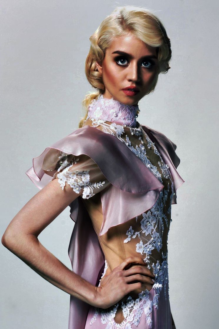 Allison Harvard