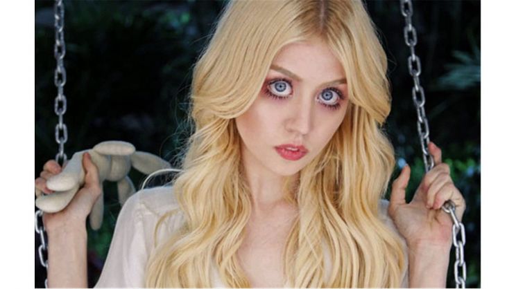 Allison Harvard