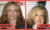 Ally Walker