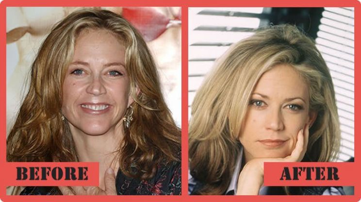 Ally Walker