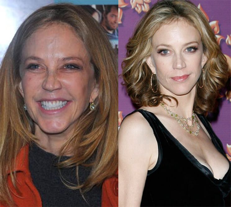 Ally Walker