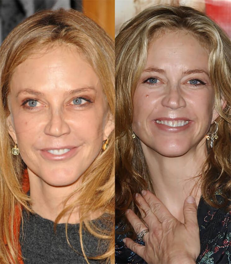 Ally Walker