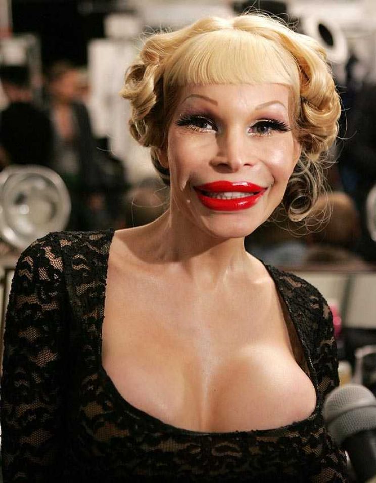 Amanda Lepore