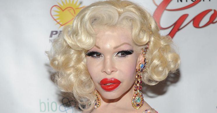 Amanda Lepore