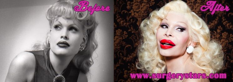 Amanda Lepore