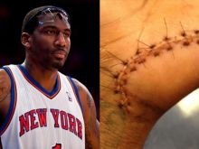 Amar'e Stoudemire