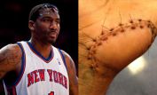 Amar'e Stoudemire