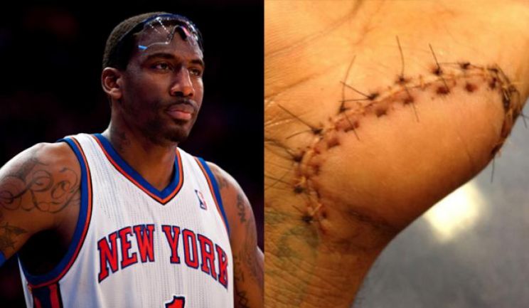 Amar'e Stoudemire