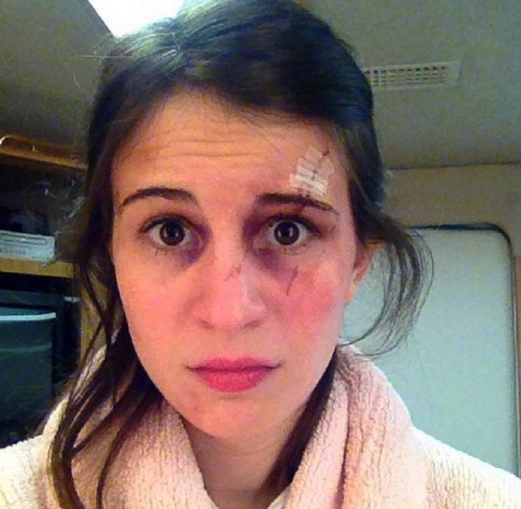 Amelia Rose Blaire