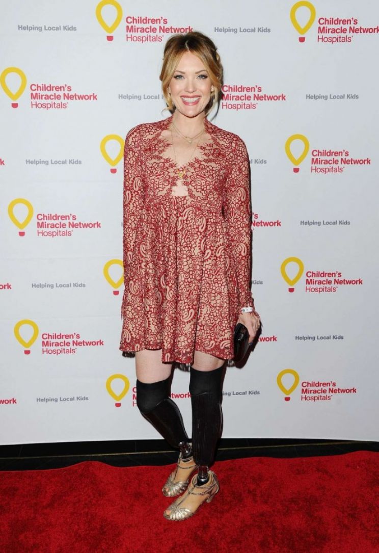 Amy Purdy