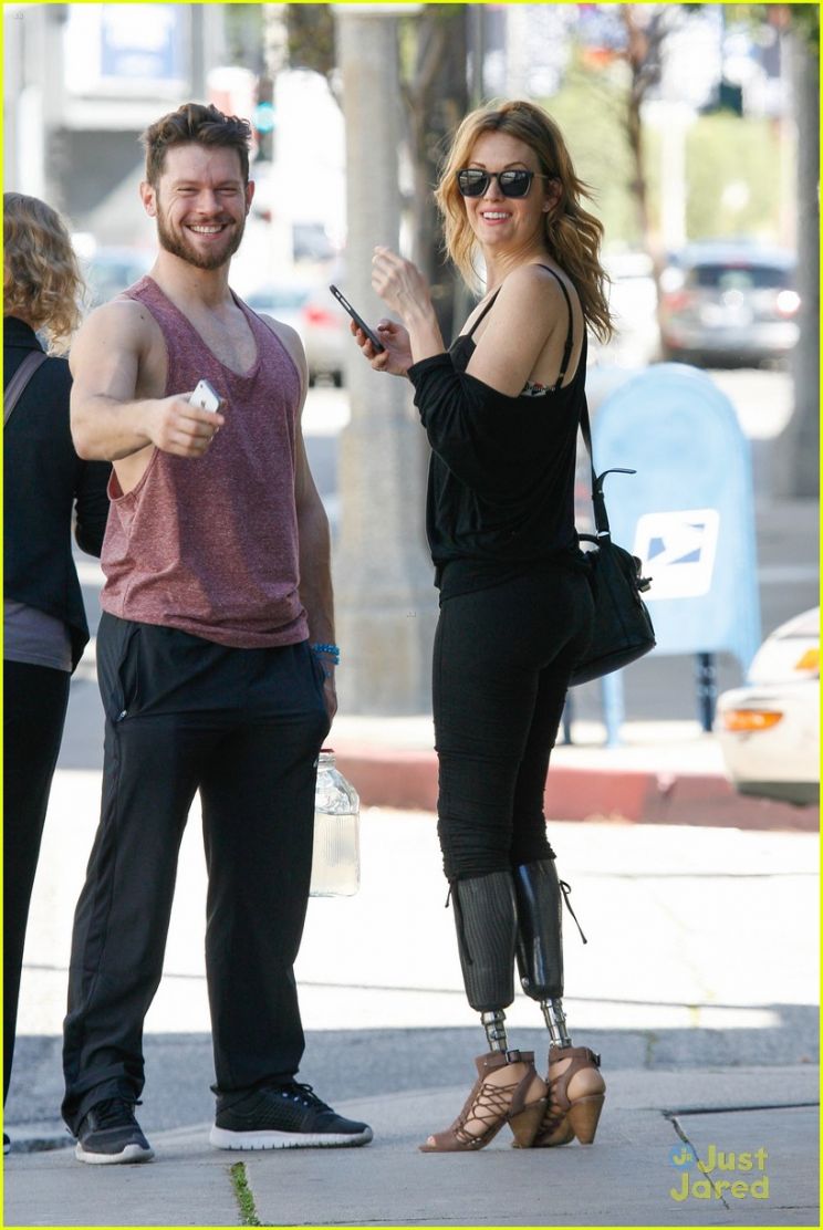 Amy Purdy