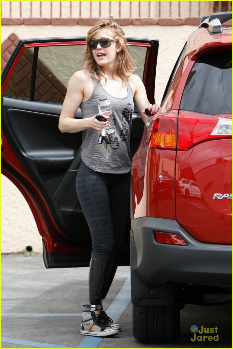 Amy Purdy