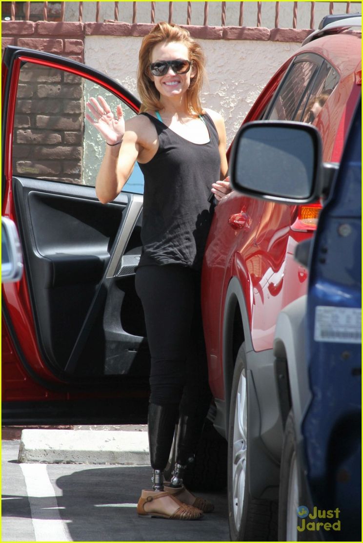 Amy Purdy
