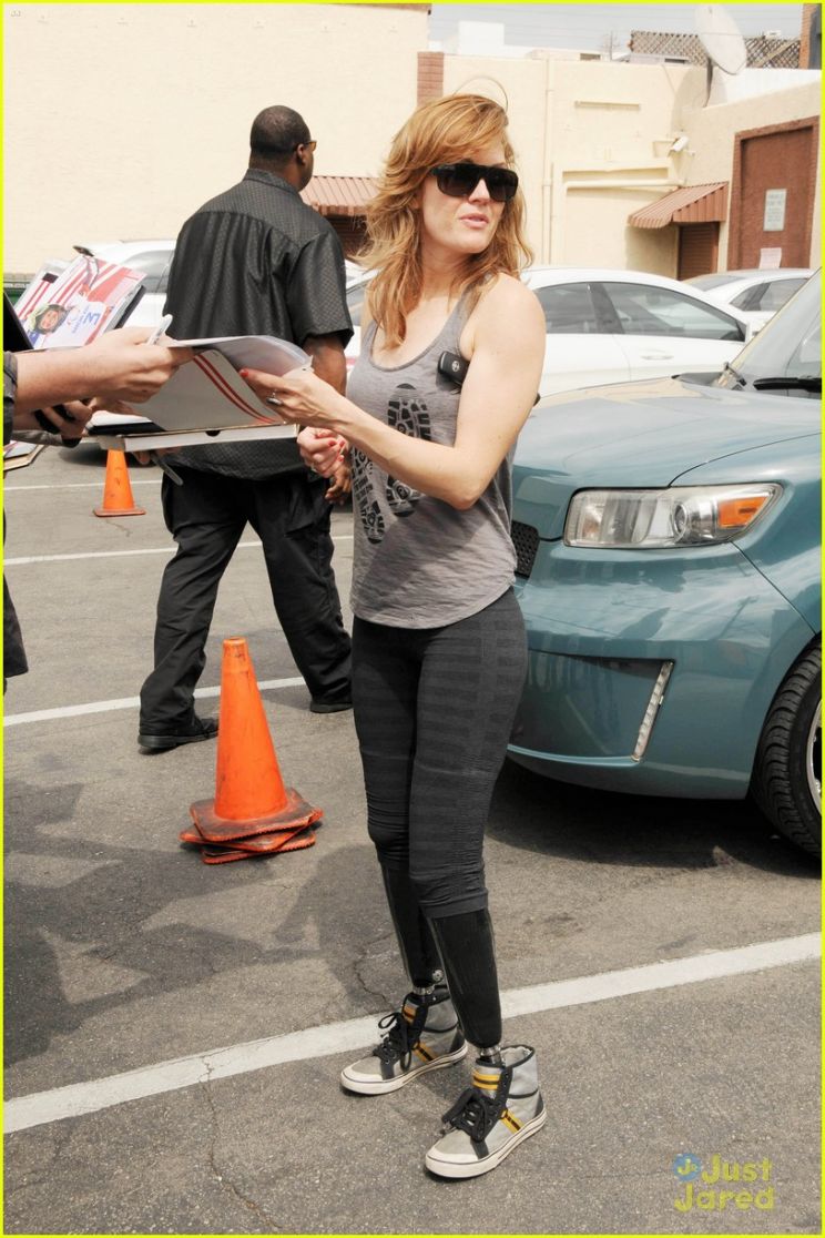 Amy Purdy