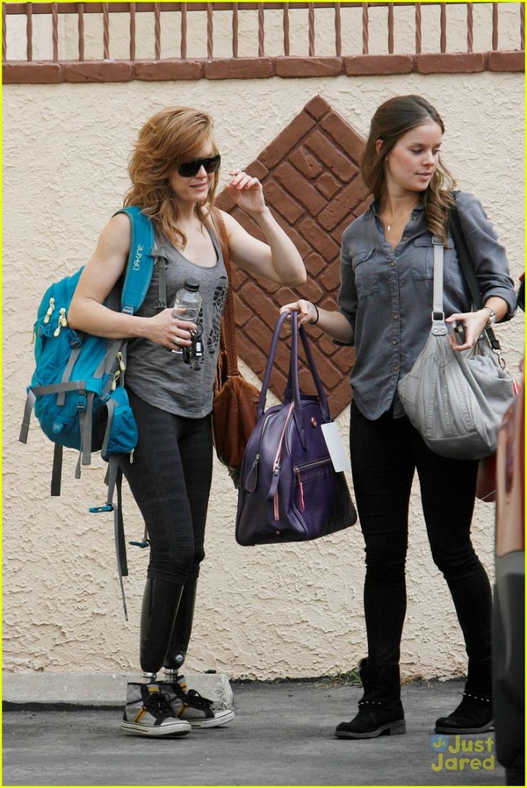 Amy Purdy