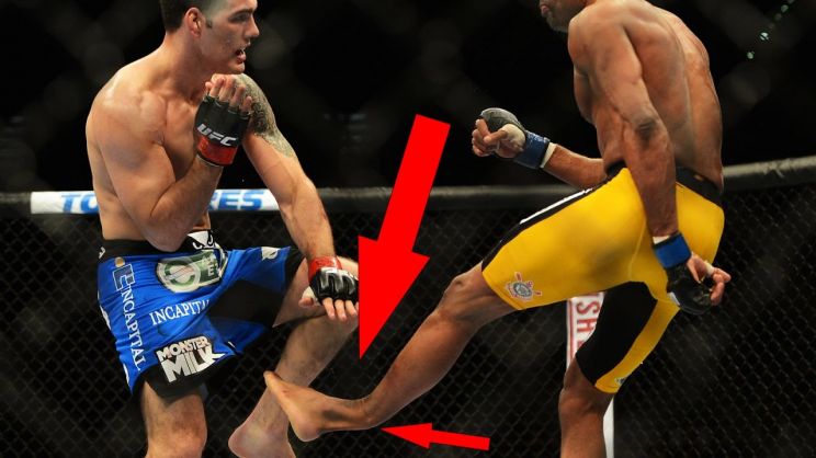 Anderson Silva