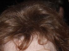 Anita Gillette