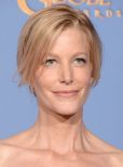 Anna Gunn