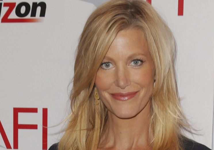 Anna Gunn