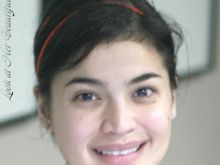 Anne Curtis