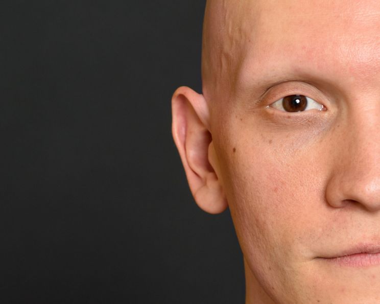 Anthony Carrigan
