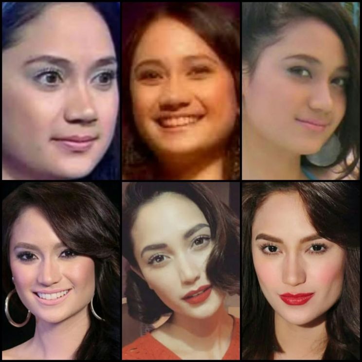 Arci Muñoz