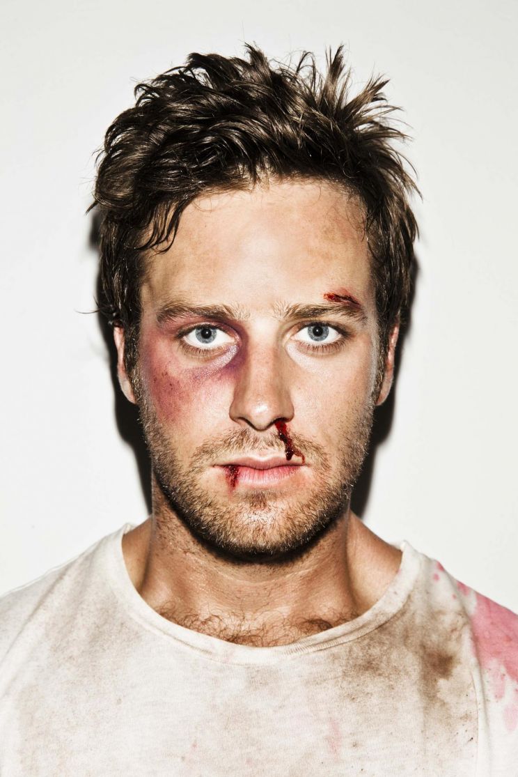 Armie Hammer