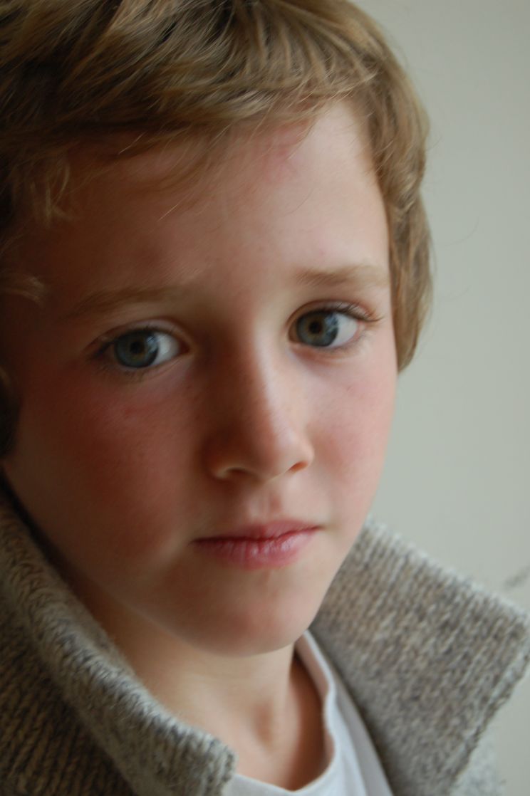 Art Parkinson