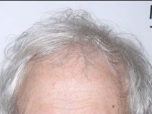 Austin Pendleton