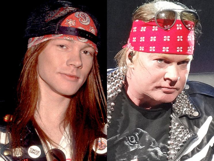 Axl Rose