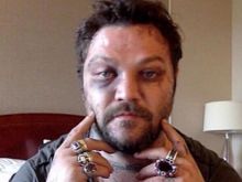 Bam Margera