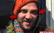 Bam Margera