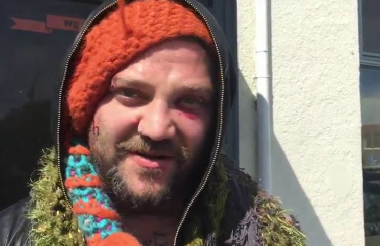 Bam Margera
