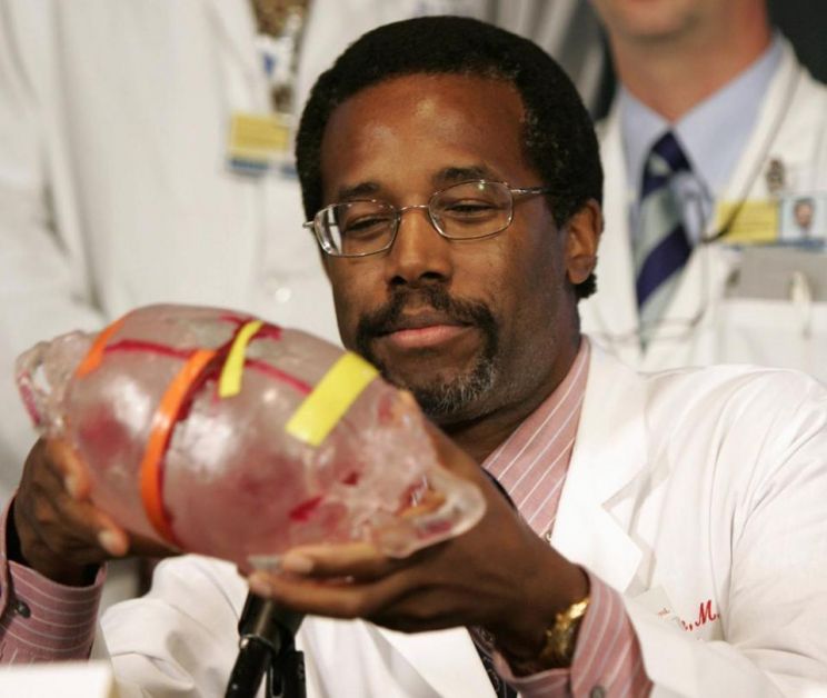 Ben Carson